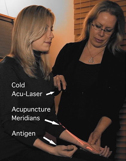 example of a cold laser treatment at Allergy and Health Solutions Center in Medford, New Jersey